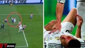 Không Penalty Cho Mbappe - Liệu Real Madrid Có Bị Xử Ép ?