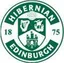 Hibernian FC U20